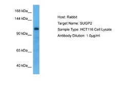 ZMIZ1/Zimp10 Antibody, Novus Biologicals 100 &mu;L; Unconjugated:Antibodies,
